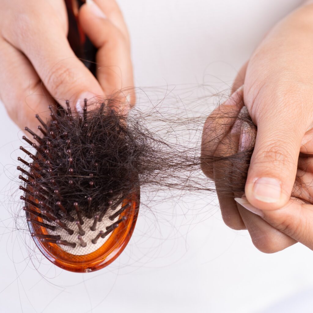 Image of excessive hair on a comb. A sign of hair loss. Treatment options for hair loss in women may be considered. 