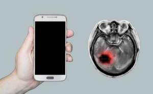 Mobile Phones and Brain Cancer Risk