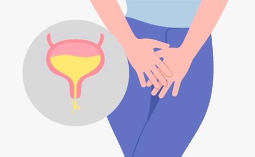 Menopause and Bladder Issues for Women in New Zealand