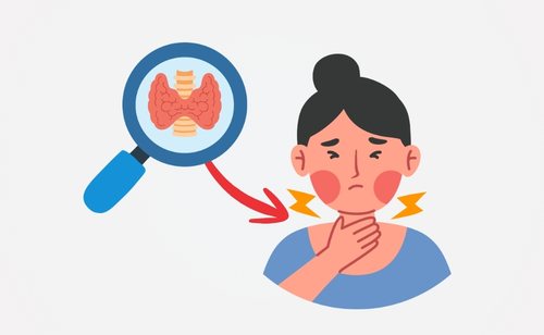 Hypothyroidism: Symptoms, Causes, Diagnosis and Treatment of Underactive Thyroid