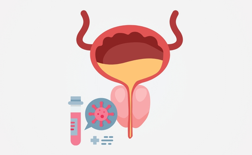 Learn about prostate cancer symptoms, risk factors, PSA testing and treatment in New Zealand. Blue September is prostate cancer awareness month.